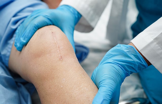Clinician in gloves examining a patient's knee with surgical scar