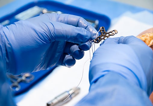 Gloved hands preparing The Summit™ Patella Plate with its attached sutures