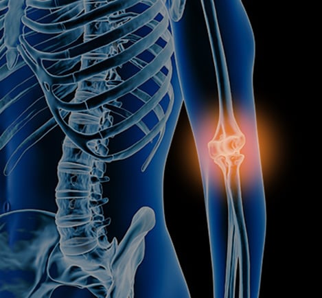 X-ray-style illustration of an elbow with the olecranon highlighted in orange