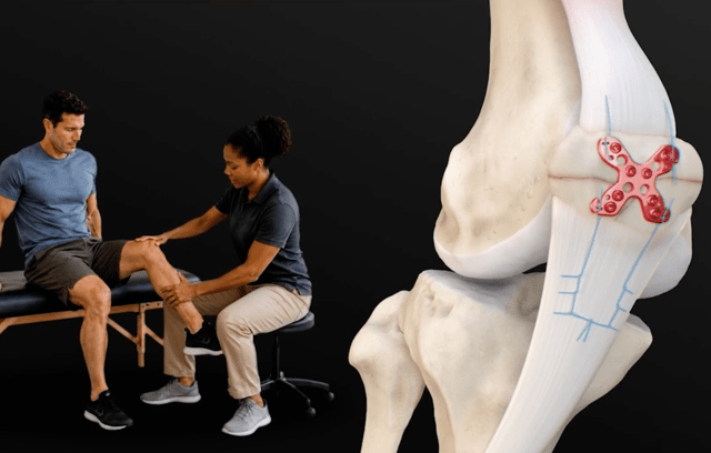 Clinical Advantages Video