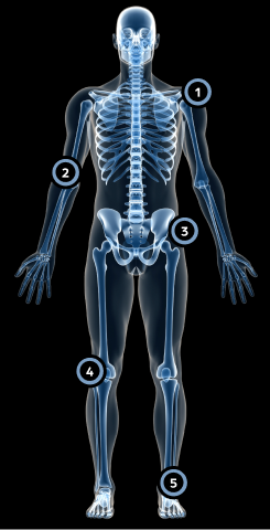 X-ray-style illustration of a human skeleton inside a translucent body outline