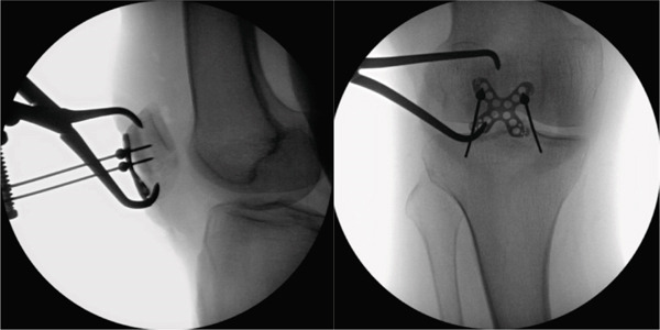 Case Report clinical image