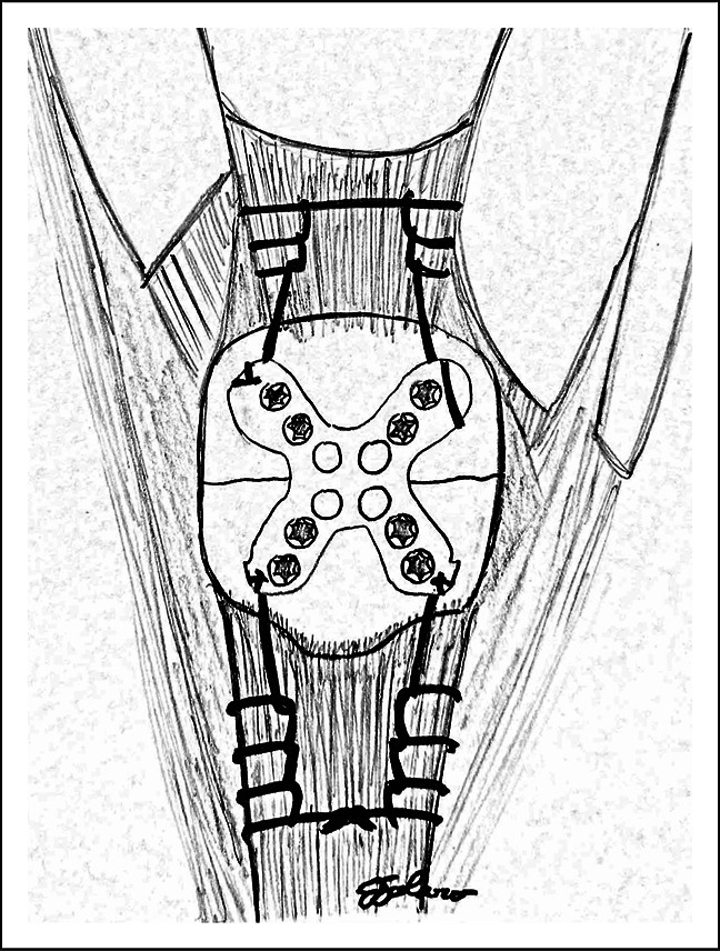 JAAOS image