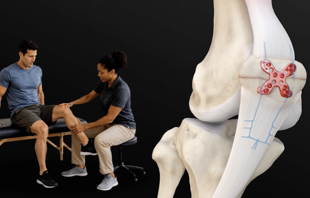 Clinical Advantages Video